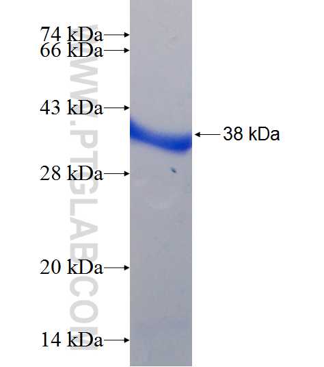 PI4K2B fusion protein Ag7120 SDS-PAGE