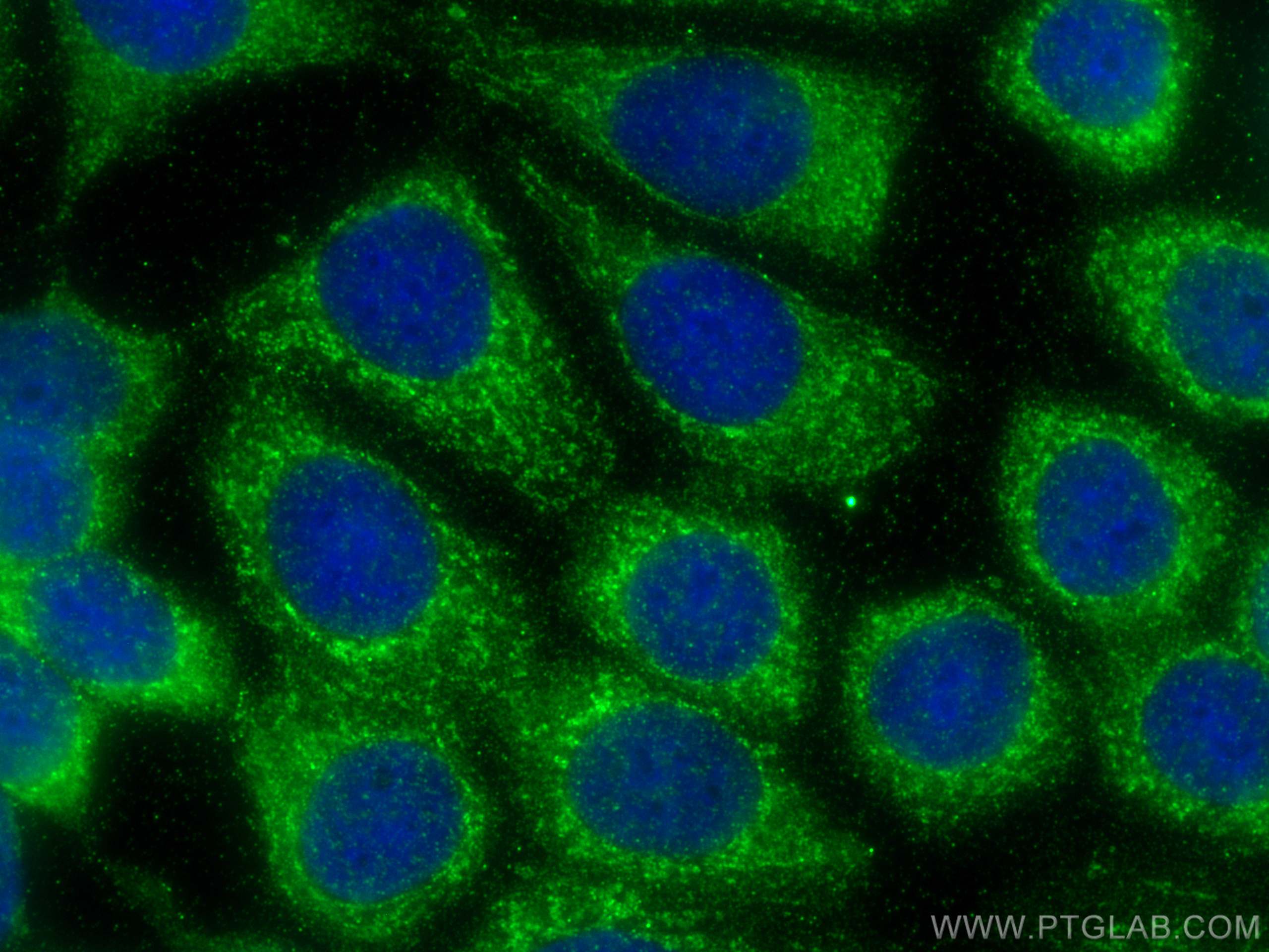 Immunofluorescence (IF) / fluorescent staining of MCF-7 cells using PI4KA Polyclonal antibody (12411-1-AP)