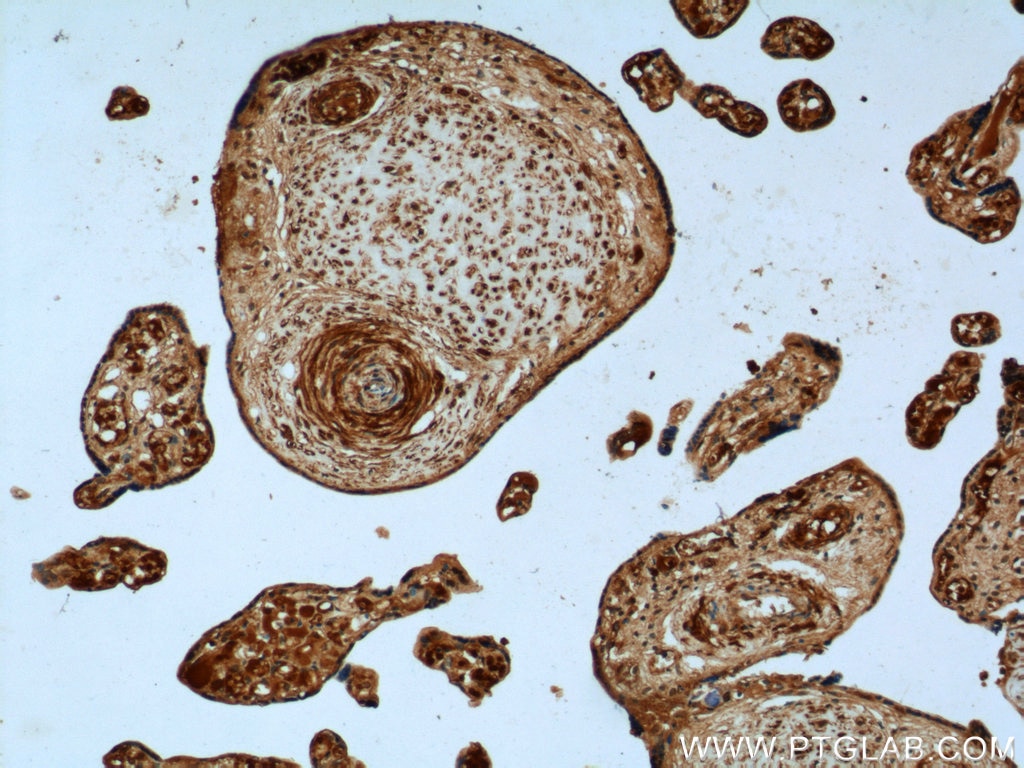 IHC staining of human placenta using 12411-1-AP