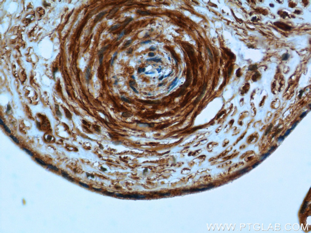 Immunohistochemistry (IHC) staining of human placenta tissue using PI4KA Polyclonal antibody (12411-1-AP)