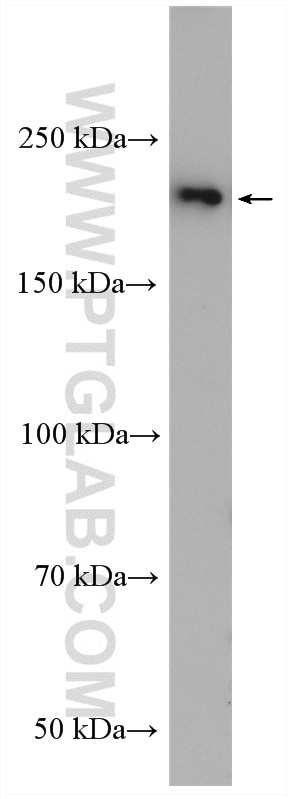 Western Blot (WB) analysis of MCF-7 cells using PI4KA Polyclonal antibody (12411-1-AP)