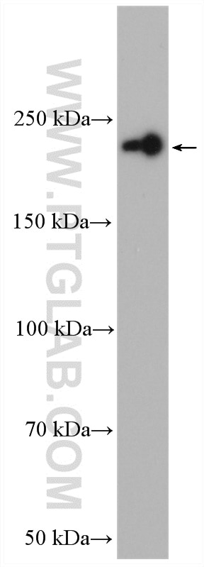 WB analysis of mouse brain using 12411-1-AP