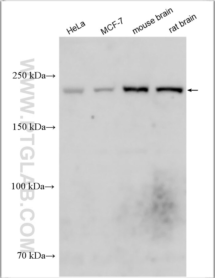 Western Blot (WB) analysis of various lysates using PI4KA Polyclonal antibody (12411-1-AP)