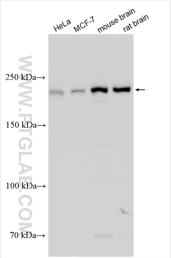 Western Blot (WB) analysis of various lysates using PI4KA Polyclonal antibody (12411-1-AP)