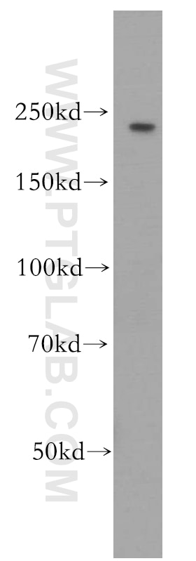 Western Blot (WB) analysis of mouse brain tissue using PI4KA Polyclonal antibody (12411-1-AP)