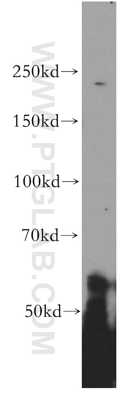 Western Blot (WB) analysis of HeLa cells using PI4KA Polyclonal antibody (12411-1-AP)