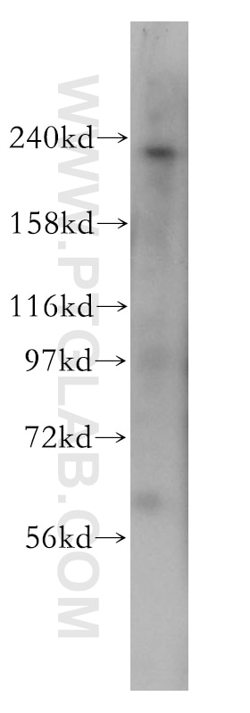 PI4KA Polyclonal antibody