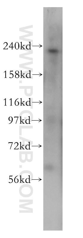 Western Blot (WB) analysis of human brain tissue using PI4KA Polyclonal antibody (12411-1-AP)