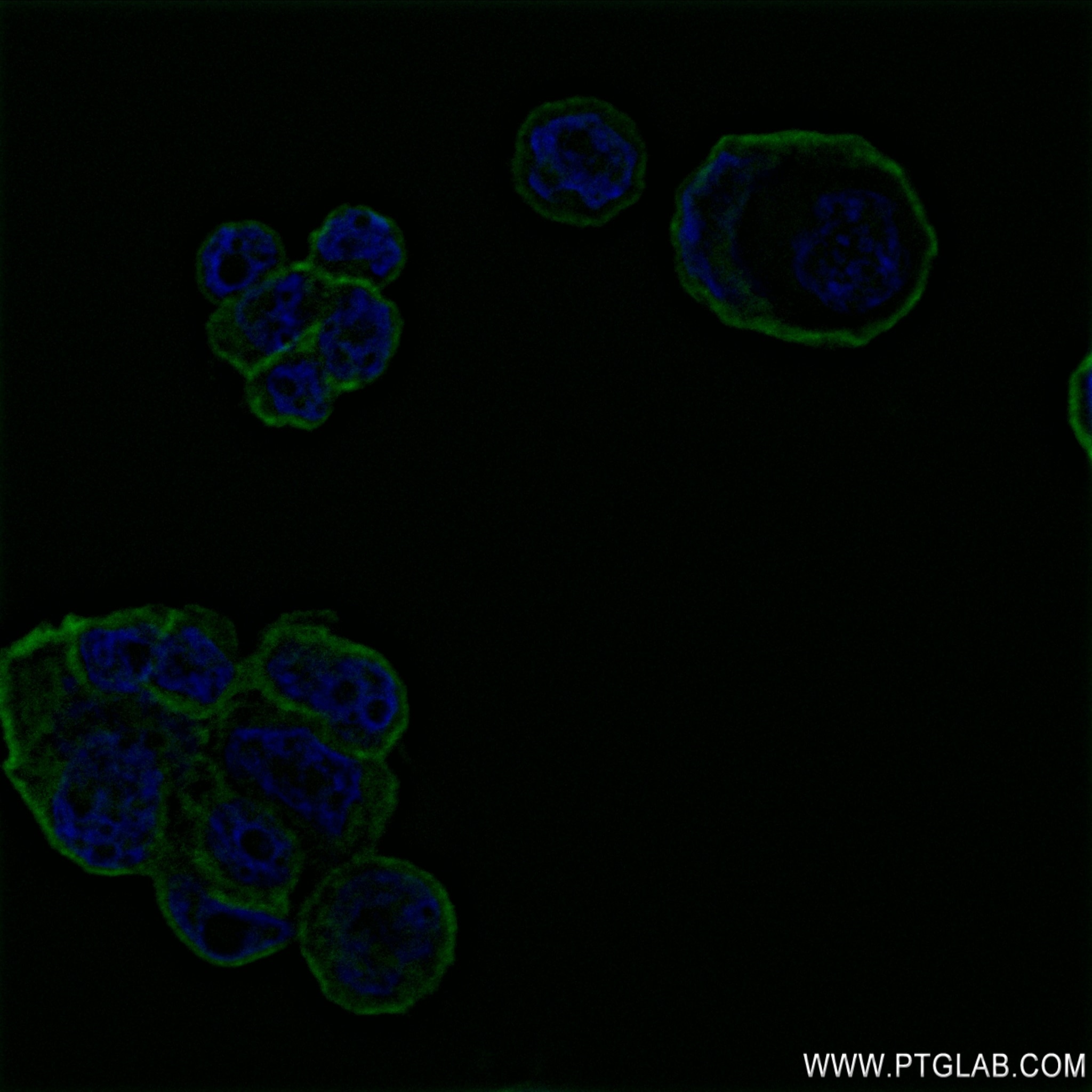 IF Staining of MCF-7 using 82938-1-RR