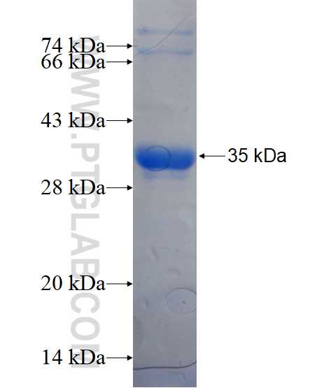 PI4KA fusion protein Ag17168 SDS-PAGE