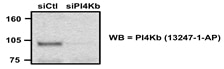 Western Blot (WB) analysis of NIH-3T3 cells (RNAi) using PI4KB Polyclonal antibody (13247-1-AP)
