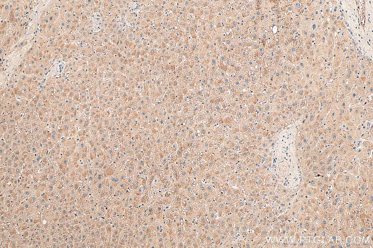 Immunohistochemistry (IHC) staining of human liver tissue using PI4KB Polyclonal antibody (13247-1-AP)