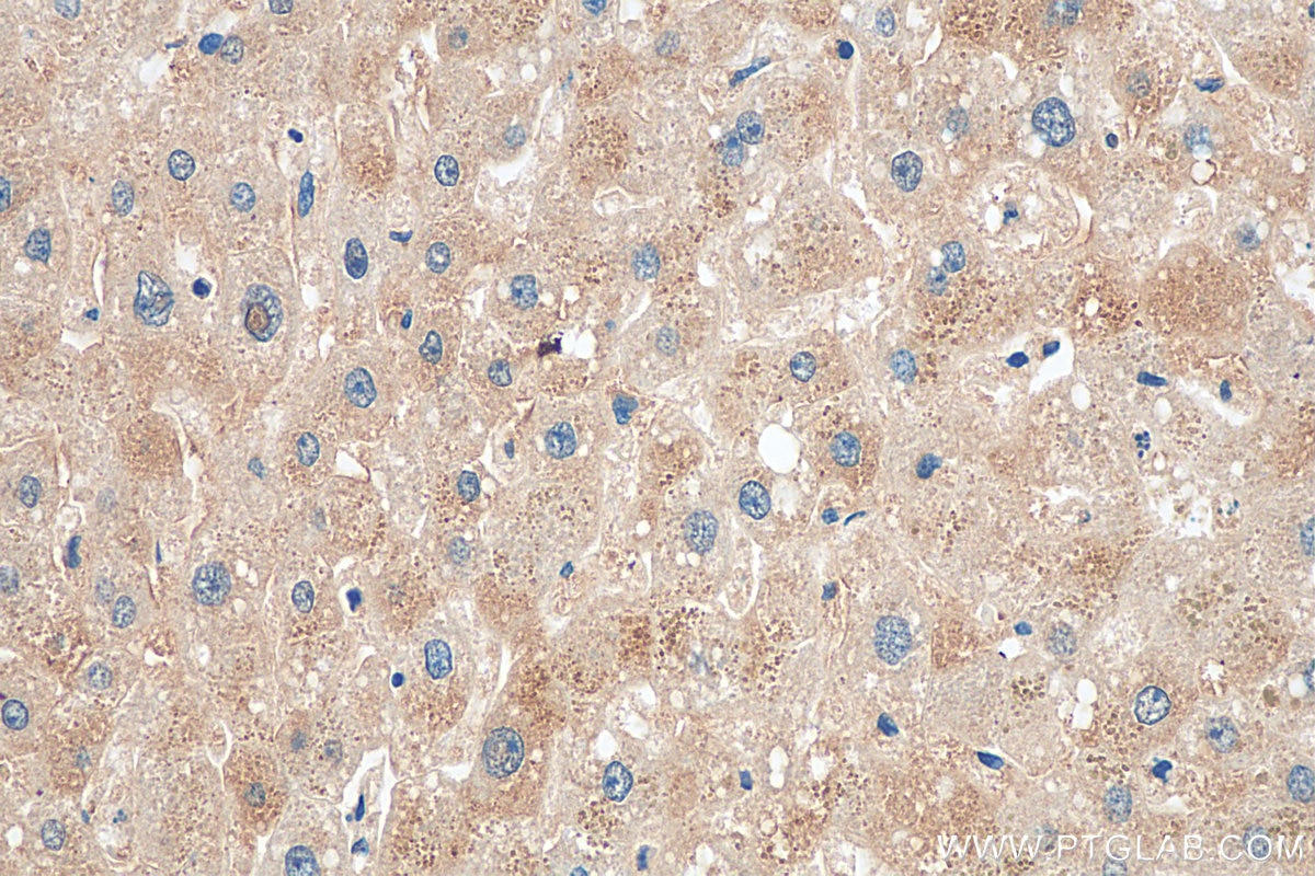Immunohistochemistry (IHC) staining of human liver tissue using PI4KB Polyclonal antibody (13247-1-AP)
