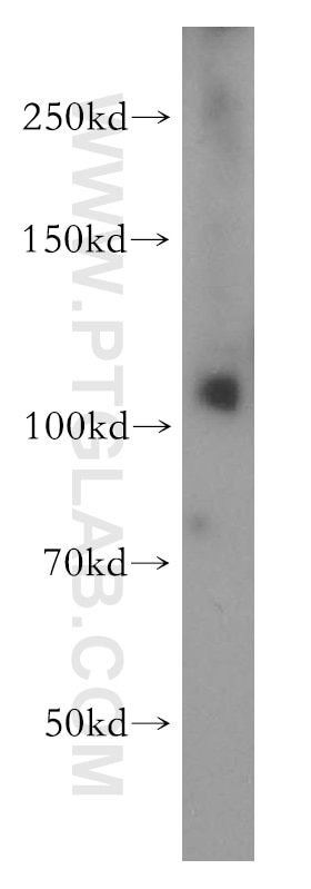 Western Blot (WB) analysis of K-562 cells using PI4KB Polyclonal antibody (13247-1-AP)