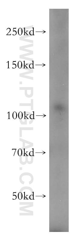 Western Blot (WB) analysis of Jurkat cells using PI4KB Polyclonal antibody (13247-1-AP)