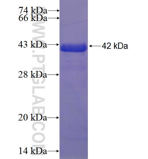 PI4KB fusion protein Ag23551 SDS-PAGE