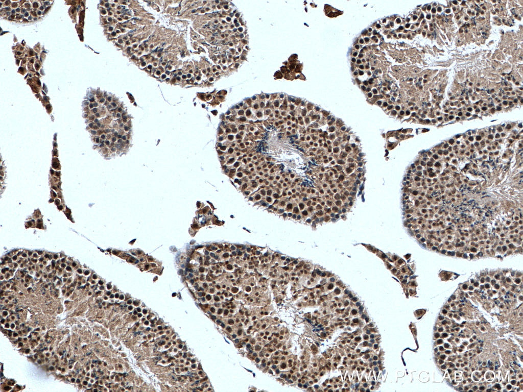 Immunohistochemistry (IHC) staining of mouse testis tissue using PIAS1 Polyclonal antibody (23395-1-AP)
