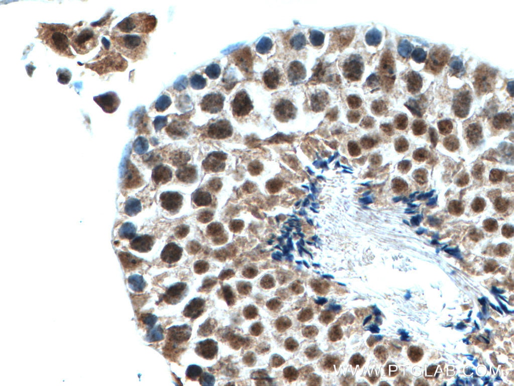 Immunohistochemistry (IHC) staining of mouse testis tissue using PIAS1 Polyclonal antibody (23395-1-AP)