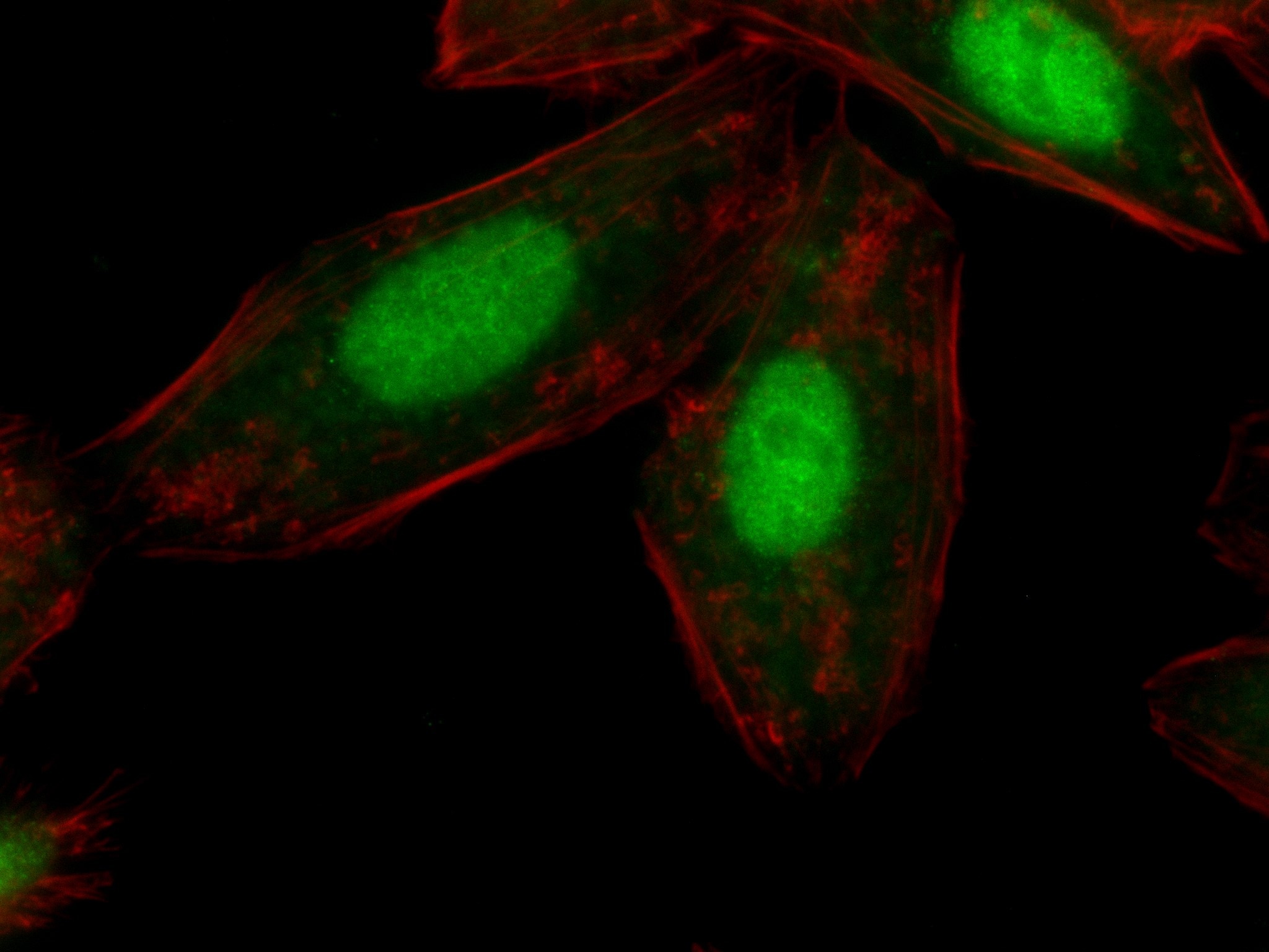 Immunofluorescence (IF) / fluorescent staining of HepG2 cells using PIAS1 Recombinant antibody (82873-2-RR)