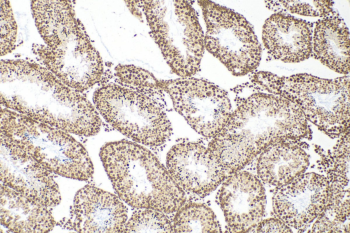 Immunohistochemistry (IHC) staining of mouse testis tissue using PIAS1 Recombinant antibody (82873-2-RR)