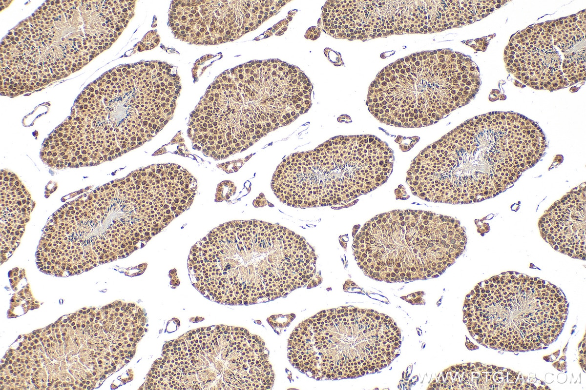 Immunohistochemistry (IHC) staining of mouse testis tissue using PIAS2 Polyclonal antibody (16074-1-AP)