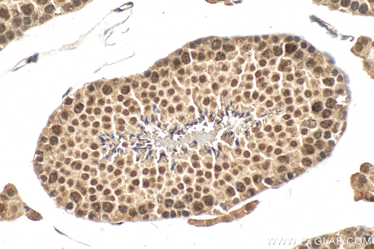 Immunohistochemistry (IHC) staining of mouse testis tissue using PIAS2 Polyclonal antibody (16074-1-AP)