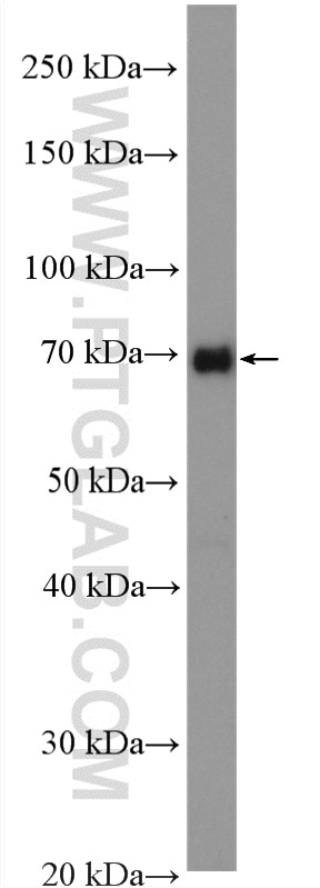 Western Blot (WB) analysis of HeLa cells using PIAS2 Polyclonal antibody (16074-1-AP)