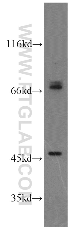 Western Blot (WB) analysis of MCF-7 cells using PIAS2 Polyclonal antibody (16074-1-AP)