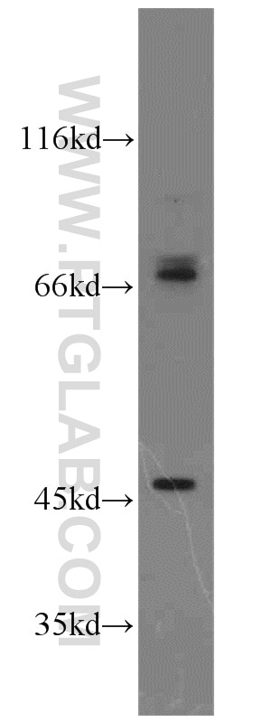 WB analysis of MCF-7 using 16074-1-AP