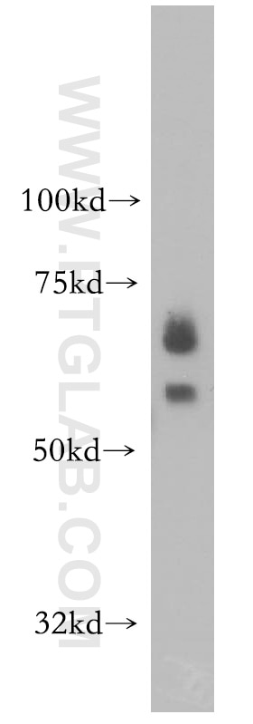 Western Blot (WB) analysis of HeLa cells using PIAS3 Polyclonal antibody (13486-1-AP)