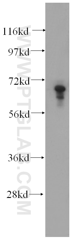 Western Blot (WB) analysis of HepG2 cells using PIAS3 Polyclonal antibody (13486-1-AP)