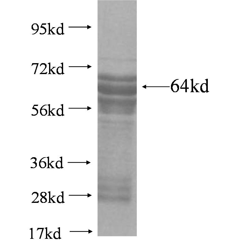 PIAS3 fusion protein Ag4304 SDS-PAGE