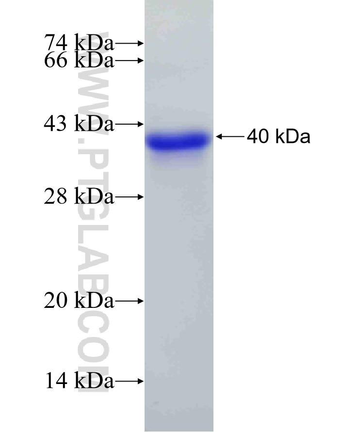 PIAS3 fusion protein Ag5774 SDS-PAGE