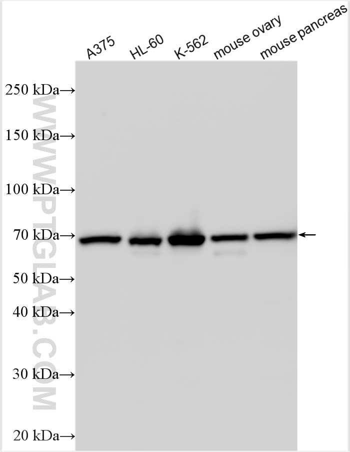 Western Blot (WB) analysis of various lysates using PIAS4 Polyclonal antibody (14242-1-AP)