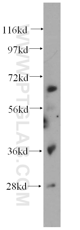 Western Blot (WB) analysis of mouse ovary tissue using PIAS4 Polyclonal antibody (14242-1-AP)
