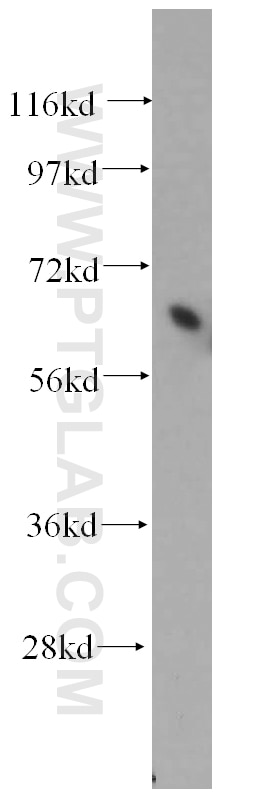 Western Blot (WB) analysis of mouse pancreas tissue using PIAS4 Polyclonal antibody (14242-1-AP)