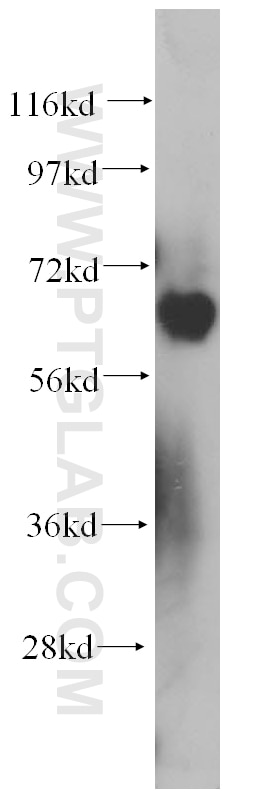 Western Blot (WB) analysis of K-562 cells using PIAS4 Polyclonal antibody (14242-1-AP)