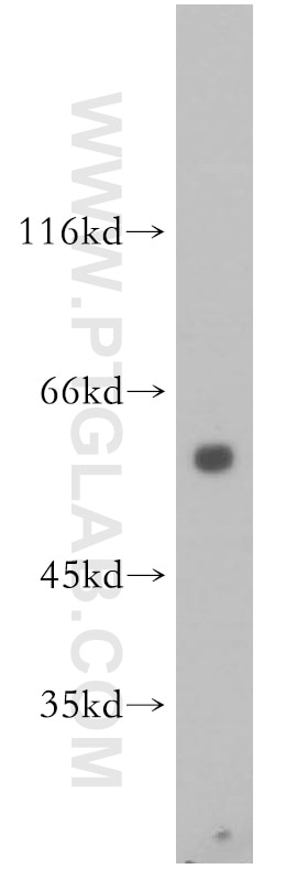 Western Blot (WB) analysis of HL-60 cells using PIAS4 Polyclonal antibody (14242-1-AP)