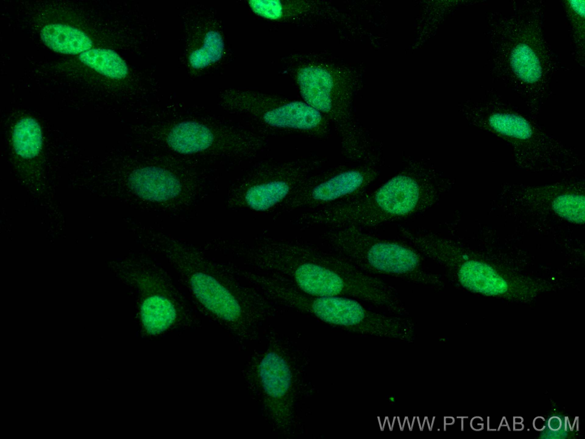 Immunofluorescence (IF) / fluorescent staining of HeLa cells using PIAS4 Polyclonal antibody (18469-1-AP)