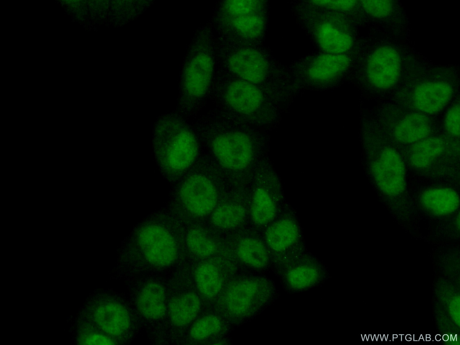 Immunofluorescence (IF) / fluorescent staining of HeLa cells using PIAS4 Polyclonal antibody (18469-1-AP)