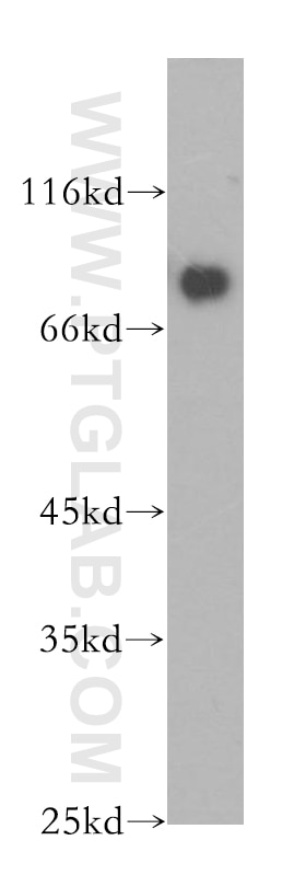 Western Blot (WB) analysis of K-562 cells using PIAS4 Polyclonal antibody (18469-1-AP)