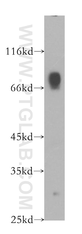 Western Blot (WB) analysis of Jurkat cells using PIAS4 Polyclonal antibody (18469-1-AP)