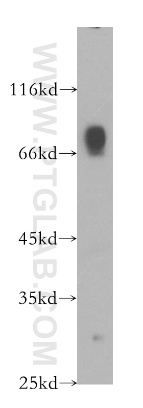 WB analysis of Jurkat using 18469-1-AP