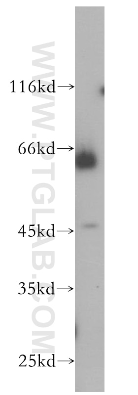 Western Blot (WB) analysis of HL-60 cells using PIAS4 Polyclonal antibody (18469-1-AP)