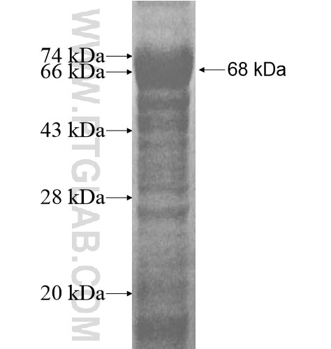 PIAS4 fusion protein Ag13316 SDS-PAGE