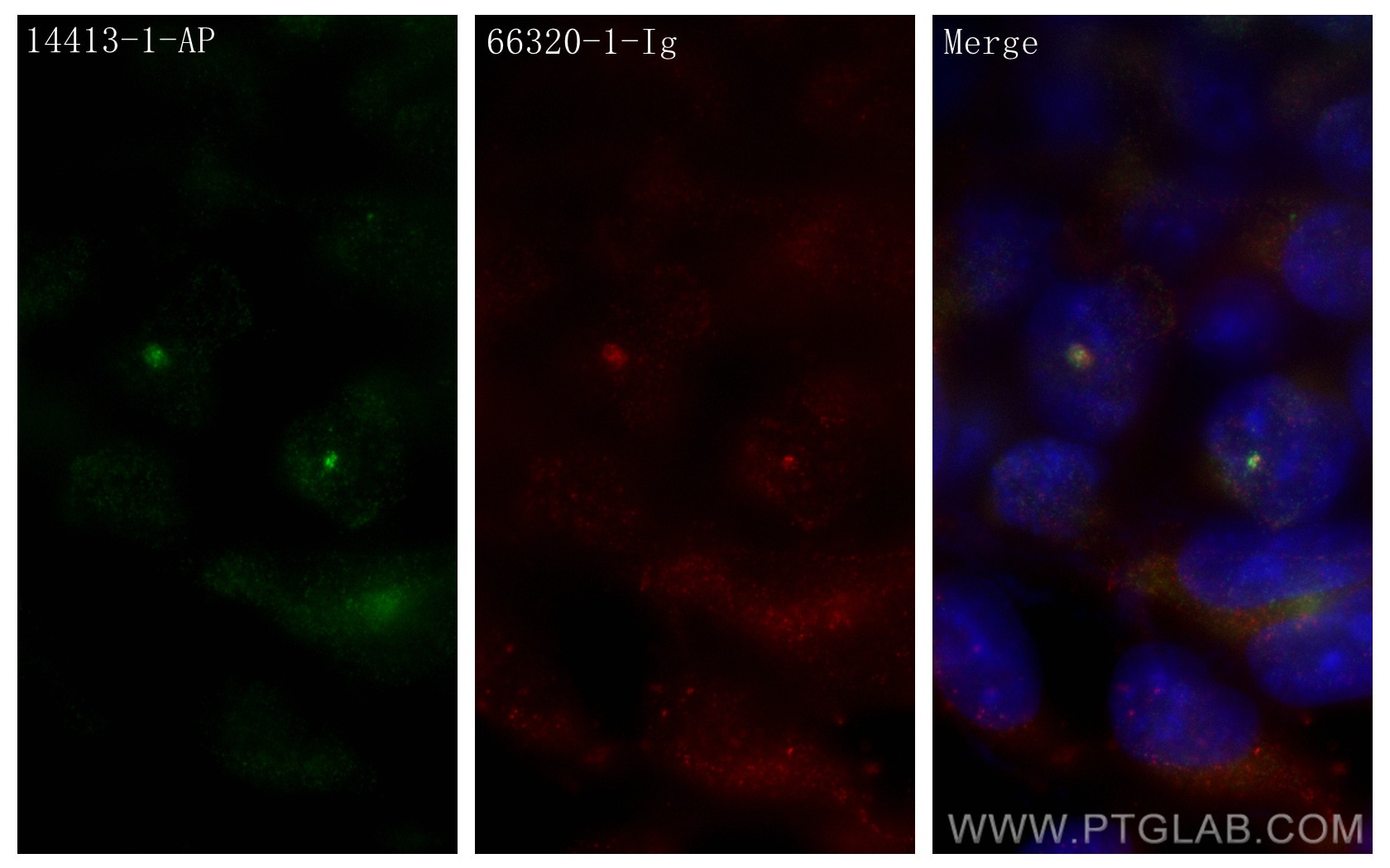 Immunofluorescence (IF) / fluorescent staining of HEK-293 cells using PIBF1 Polyclonal antibody (14413-1-AP)