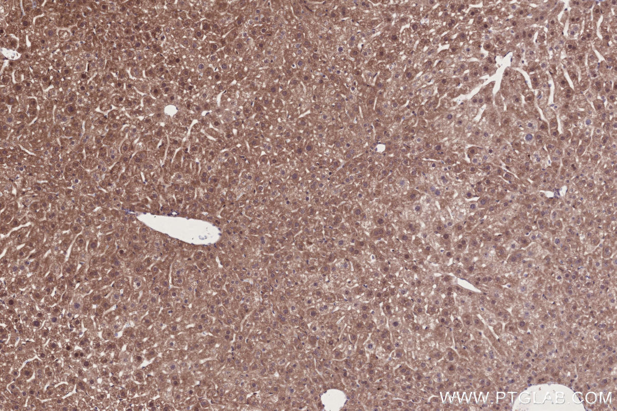 IHC staining of mouse liver using 14413-1-AP Immunohistochemistry (IHC) staining of mouse liver tissue using PIBF1 Polyclonal antibody (14413-1-AP)