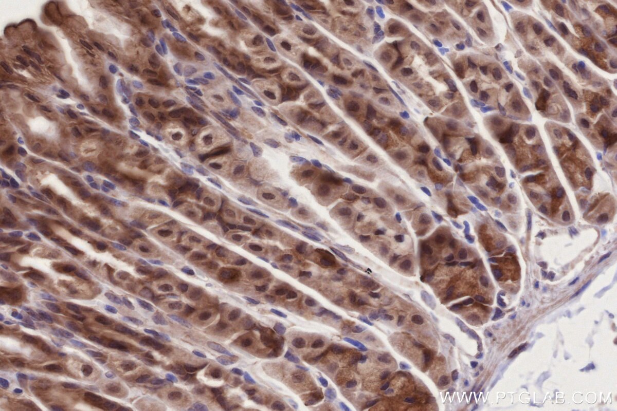 IHC staining of mouse stomach using 14413-1-AP Immunohistochemistry (IHC) staining of mouse stomach tissue using PIBF1 Polyclonal antibody (14413-1-AP)