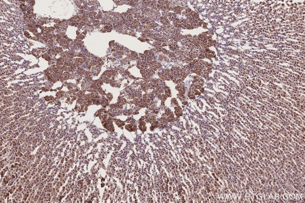 IHC staining of rat adrenal gland using 14413-1-AP Immunohistochemistry (IHC) staining of rat adrenal gland tissue using PIBF1 Polyclonal antibody (14413-1-AP)