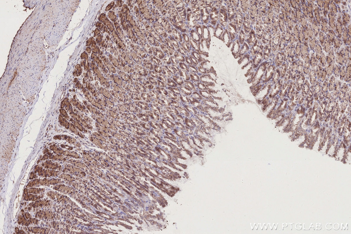 IHC staining of rat stomach using 14413-1-AP Immunohistochemistry (IHC) staining of rat stomach tissue using PIBF1 Polyclonal antibody (14413-1-AP)